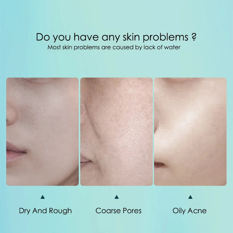 20pcs Hyaluronic Acid & Collagen Face Mask- Korean Skin Care